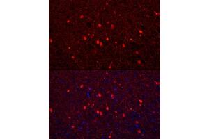 Immunofluorescence analysis of mouse brain using Calretinin Rabbit pAb (ABIN6129247, ABIN6137849, ABIN6137850 and ABIN6225108) at dilution of 1:250 (40x lens). (Calretinin antibody  (AA 1-271))