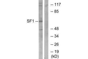 Western blot analysis of extracts from COLO205 cells, using SF1 (Ab-82) antibody. (Splicing Factor 1 antibody  (Ser82))
