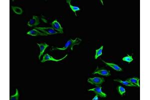 Immunofluorescent analysis of Hela cells using ABIN7149414 at dilution of 1:100 and Alexa Fluor 488-congugated AffiniPure Goat Anti-Rabbit IgG(H+L) (PLA2G4A antibody  (AA 379-533))