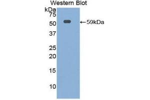 Western Blotting (WB) image for anti-Interleukin 10 Receptor, alpha (IL10RA) (AA 17-241) antibody (ABIN1859329)