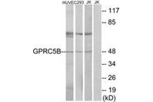 Western blot analysis of extracts from Jurkat/HuvEc/293 cells, using GPRC5B Antibody.