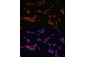 Immunofluorescence analysis of NIH-3T3 cells using YWHAH Polyclonal Antibody (ABIN6131142, ABIN6150348, ABIN6150349 and ABIN6224884) at dilution of 1:100 (40x lens). (14-3-3 eta antibody  (AA 1-246))