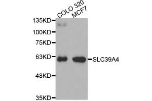 Western Blotting (WB) image for anti-Solute Carrier Family 39 (Zinc Transporter), Member 4 (SLC39A4) antibody (ABIN1874832) (SLC39A4 antibody)