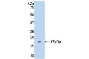 Detection of Recombinant ANXA5, Human using Polyclonal Antibody to Complement 1 Inhibitor (C1INH) (SERPING1 antibody  (AA 399-500))