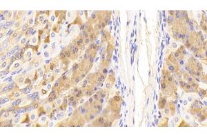 Detection of PGC in Mouse Stomach Tissue using Polyclonal Antibody to Pepsinogen C (PGC) (PGC antibody  (AA 17-392))