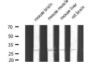 Western blot analysis of extracts of various tissue sample,using MYF5 Antibody . (MYF5 antibody  (N-Term))