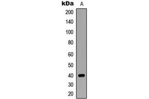 Western blot analysis of SIAH2 expression in MCF7 (A) whole cell lysates. (SIAH2 antibody  (C-Term))