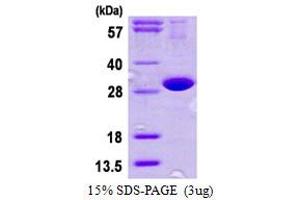 SDS-PAGE (SDS) image for DnaJ (Hsp40) Homolog, Subfamily B, Member 8 (DNAJB8) (AA 1-232) protein (His tag) (ABIN667592) (DNAJB8 Protein (AA 1-232) (His tag))