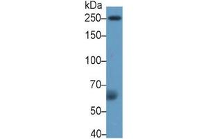 Western Blotting (WB) image for Coagulation Factor V (F5) ELISA Kit (ABIN6574187)