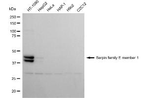 Western blotting analysis using serpin family E member 1 antibody (ABIN7799845).