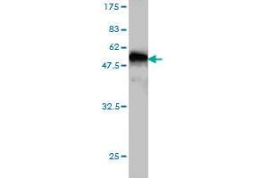 Western Blot detection against Immunogen (45. (PRKRIP1 antibody  (AA 1-184))