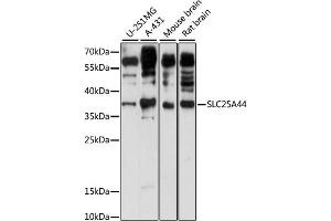 Western blot analysis of extracts of various cell lines, using SLC25 antibody (ABIN7270439) at 1:1000 dilution. (SLC25A44 antibody  (AA 90-190))