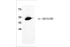 Antigen: GST-LCN2 (ABIN2703637) full length recombinant protein 2 ng  Primary Antibody: Anti-LCN2 monoclonal (PA348-26. (Lipocalin 2 antibody)