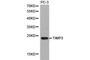 Western Blotting (WB) image for anti-TIMP Metallopeptidase Inhibitor 3 (TIMP3) antibody (ABIN1875099) (TIMP3 antibody)