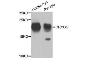 Western blot analysis of extracts of various cell lines, using CRYGS antibody. (CRYGS antibody  (AA 1-178))
