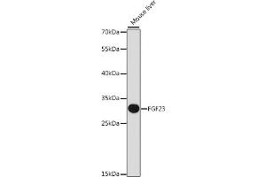 Western blot analysis of extracts of mouse liver, using FGF23 antibody (ABIN6133696, ABIN6140599, ABIN6140601 and ABIN6218305) at 1:1000 dilution. (FGF23 antibody  (AA 100-200))