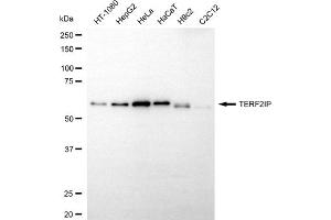 Western blotting analysis using TERF2IP antibody (ABIN7800529).