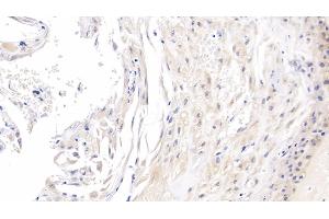 Detection of ROS1 in Human Placenta Tissue using Monoclonal Antibody to C-Ros Oncogene 1, Receptor Tyrosine Kinase (ROS1) (ROS1 antibody  (AA 1945-2222))