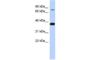 WB Suggested Anti-ZNF526 Antibody Titration:  0.