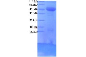 SDS-PAGE (SDS) image for DCP2 Decapping Enzyme Homolog (DCP2) (AA 1-385), (Isoform 2) protein (His tag) (ABIN4976209) (DCP2 Protein (AA 1-385, Isoform 2) (His tag))