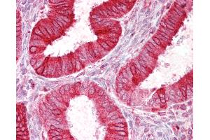 Anti-SCNN1D antibody IHC of human uterus. (SCNN1D antibody  (AA 694-704))
