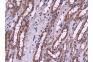 #VALUE! (HDAC4 antibody  (AA 904-1076))