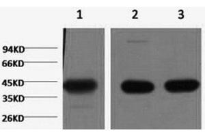 Western Blot analysis of 1) Hela, 2) Mouse brain, 3) Rat brain using ACTA1 Monoclonal Antibody at dilution of 1:1000. (Actin antibody)