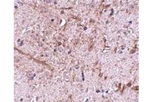 Immunohistochemistry (IHC) image for anti-Translocase of Outer Mitochondrial Membrane 70 (TOMM70A) (N-Term) antibody (ABIN1031635) (TOM70 antibody  (N-Term))