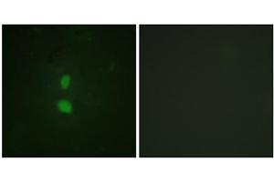 Immunofluorescence analysis of HuvEc cells, using SNAI1 (Phospho-Ser246) antibody. (SNAIL antibody  (pSer246))