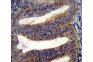 RBPMS2 antibody immunohistochemistry analysis in formalin fixed and paraffin embedded human uterus tissue. (RBPMS2 antibody  (AA 113-141))