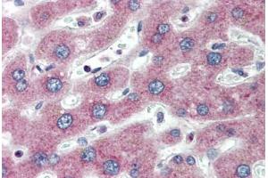 Human Liver (formalin-fixed, paraffin-embedded) stained with PTHR1 antibody ABIN334275 at 5 ug/ml followed by biotinylated anti-mouse IgG secondary antibody ABIN481714, alkaline phosphatase-streptavidin and chromogen. (PTH1R antibody  (AA 146-169))