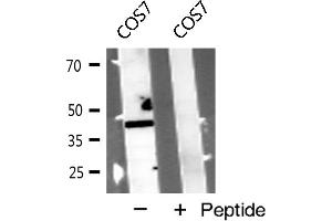 Western blot analysis of CLTR1 expression in COS7 cells (CysLTR1 antibody)