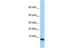 WB Suggested Anti-RPS28 Antibody Titration: 1. (RPS28 antibody  (N-Term))