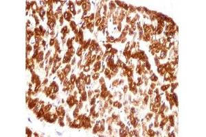 Immunohistochemistry (IHC) image for anti-Desmin (DES) (AA 332-359) antibody (ABIN3030719)