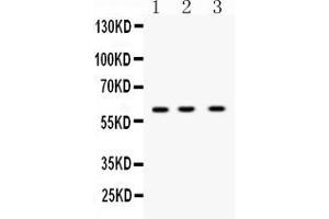 Western blot analysis of DR5 expression in rat thymus extract ( Lane 1), mouse cardiac muscle extract ( Lane 2) and K562 whole cell lysates ( Lane 3).