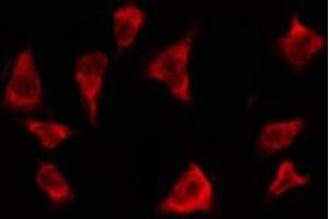 ABIN6278606 staining MCF7 by IF/ICC. (OR2T3/2T34 antibody)