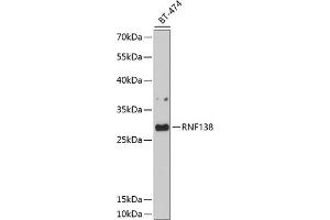 Western blot analysis of extracts of BT-474 cells, using RNF138 antibody (ABIN6128751, ABIN6147014, ABIN6147015 and ABIN6214506) at 1:1000 dilution. (RNF138 antibody)