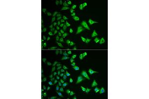 Immunofluorescence analysis of HeLa cells using DHRS2 antibody (ABIN5973846). (DHRS2 antibody)