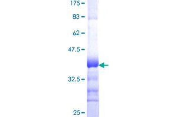 CPNE7 Protein (AA 460-558) (GST tag)