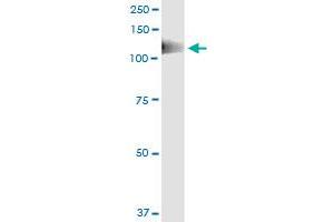 PTK2B (Human) IP-WB Antibody Pair