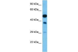 Host:  Mouse  Target Name:  FEN1  Sample Tissue:  Mouse Testis  Antibody Dilution:  1ug/ml (FEN1 antibody  (N-Term))