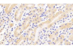 Detection of TPSb2 in Mouse Kidney Tissue using Polyclonal Antibody to Tryptase Beta 2 (TPSb2) (TPSB2 antibody  (AA 30-276))