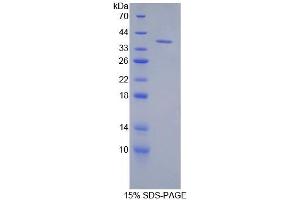 SDS-PAGE analysis of Mouse Keratin 71 Protein. (Keratin 71 Protein (KRT71))
