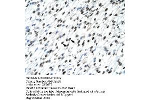 Human Heart (HOXB9 antibody  (N-Term))