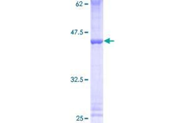 ZNF93 Protein (AA 1-123) (GST tag)