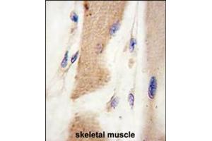Formalin-fixed and paraffin-embedded human skeletal muscle tissue reacted with CDH15 antibody , which was peroxidase-conjugated to the secondary antibody, followed by DAB staining.