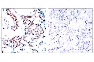 Immunohistochemistry (IHC) image for anti-Jun Proto-Oncogene (JUN) (Tyr170) antibody (ABIN1848122) (C-JUN antibody  (Tyr170))