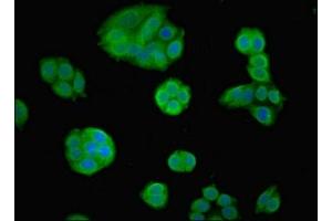 Immunofluorescent analysis of PC-3 cells using ABIN7153092 at dilution of 1:100 and Alexa Fluor 488-congugated AffiniPure Goat Anti-Rabbit IgG(H+L) (FOXP1 antibody  (AA 541-677))