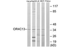 Western Blotting (WB) image for anti-Olfactory Receptor, Family 4, Subfamily C, Member 13 (OR4C13) (AA 260-309) antibody (ABIN2891003) (OR4C13 antibody  (AA 260-309))