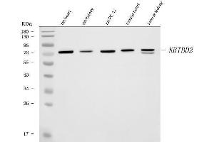 Western blot analysis of KBTBD2 using anti-KBTBD2 antibody (ABIN6719647). (KBTBD2 antibody)